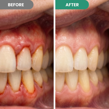 Gel de réparation dentaire CureEnd™