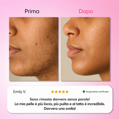 Dermelia - Kit Trilogy per la depilazione