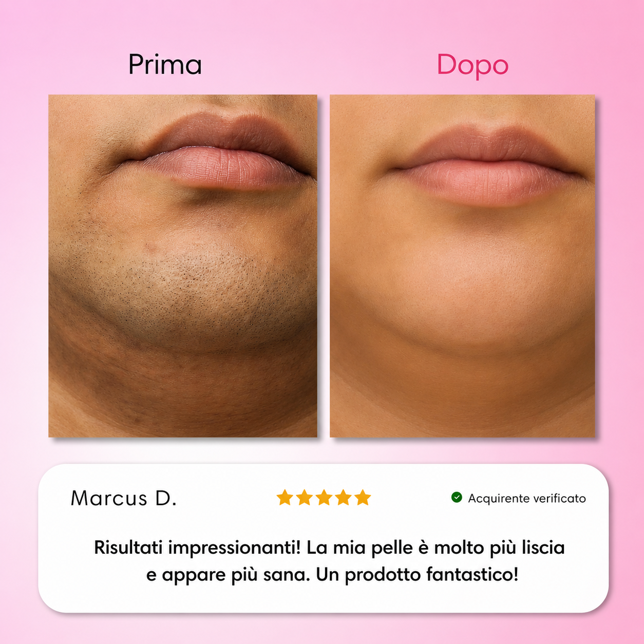 Dermelia - Kit Trilogy per la depilazione